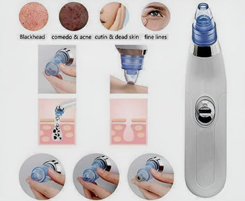 Derma Suction Blackhead Remover Vacuum Suck The Yuck Out Of Your Pores (Cell Operated)